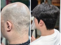 30대 전체가발 작업완성 후기