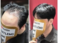 100인모 남자가발 차분함과 모발의 건강도까…