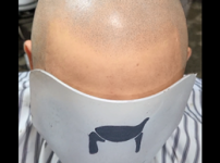 30대 남자전체가발 쉐도우댄디펌 후기 자료