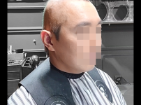 항암치료 전체가발 피팅영상 및 현장피팅영상