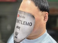 50대 반전체가발 (반전두) 시술후기