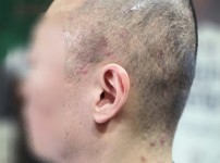 결혼식 준비로 전체가발 도전.. 실패 후 젠…