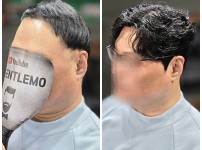 화상으로 인한 반전두 남자가발