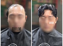 가발의 이마라인의 자연스러움으로부터 나올수 …